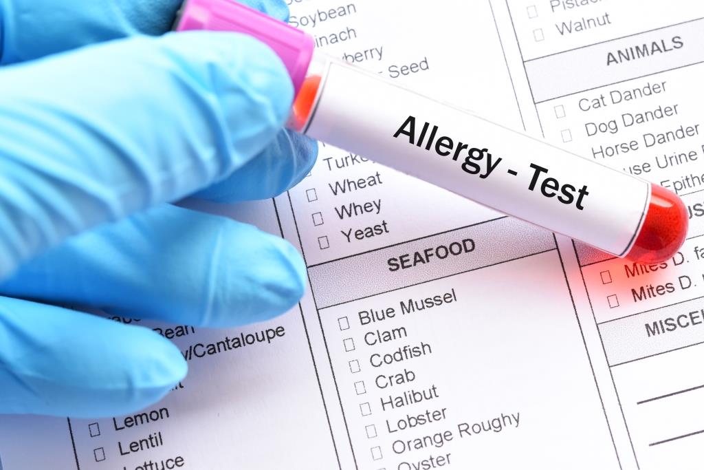 Allergiára gyanakszik? Először az orvos, aztán a teszt!