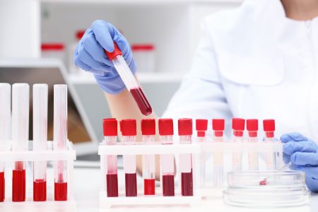 Magas lipoprotein(a)-szint - fontos tudni erről az örökletes lipidzavarról