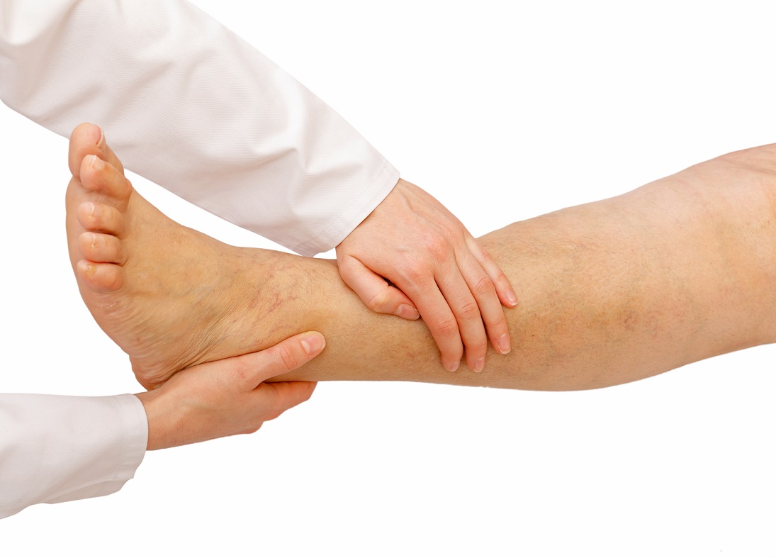 Hogyan kezelhető a lábszárfekély?