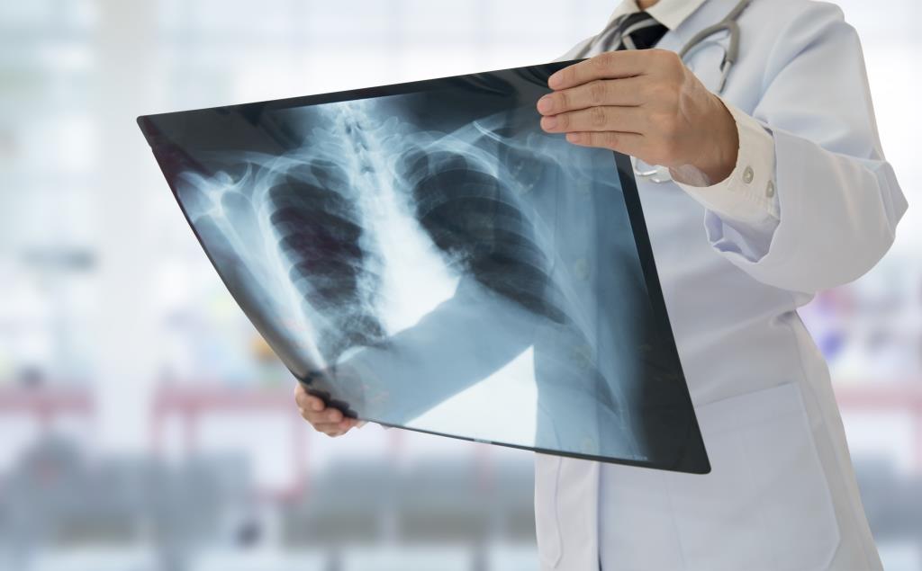 Sokarcú betegség: november 15. a COPD Világnapja