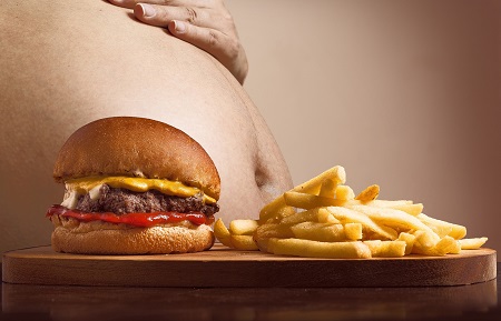 Ezért fontos elhízás esetén a kardiológiai kivizsgálás