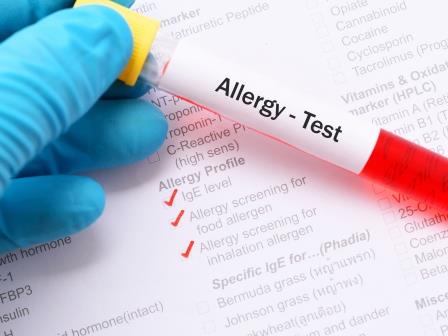 Miért végeznek allergiatesztet asztma kivizsgálása során?
