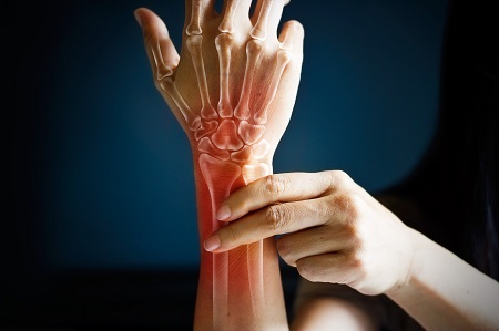 Az ujjfájdalom oka lehet ízületi gyulladás, idegbántalom, sérülés is.
