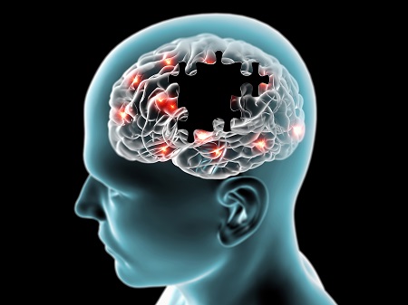 A COVID neurológiai szövődménye kivizsgálást, kezelést igényelhetnek.