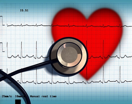 A 7 napos Holter EKG segít megfigyelni hogyan zajlik a szívritmuszavar.