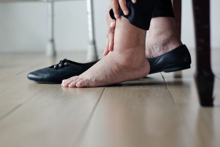 A lábdagadás, ödéma oka sokszor szívbetegség, amit kezelni kell.