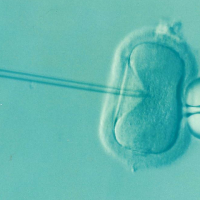 Lombikosok figyelem! Az IVF procedúra megnöveli a trombózis esélyét!