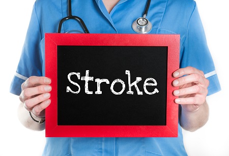 Veszélyezteti-e Önt a stroke?