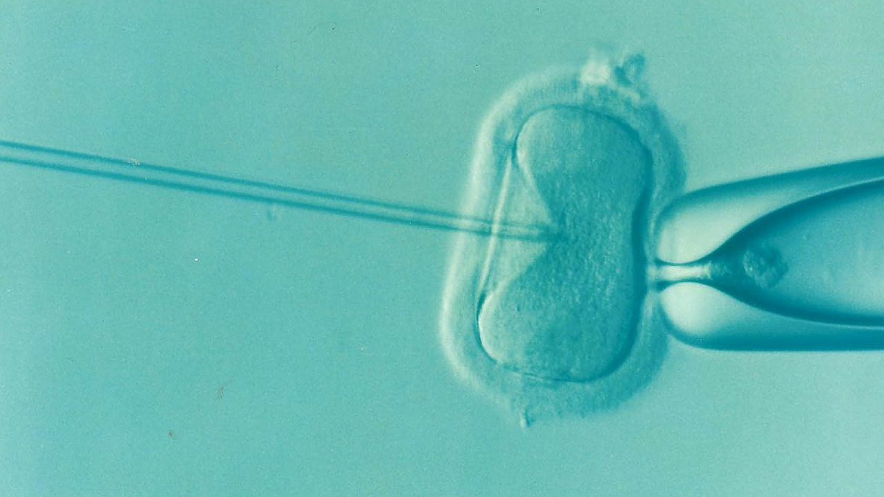 Lombikosok figyelem! Az IVF procedúra megnöveli a trombózis esélyét!