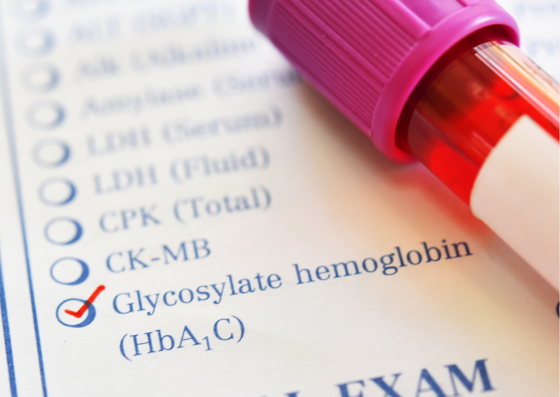 HbA1c érték: mit jelez a cukorbeteg laboreredményében?