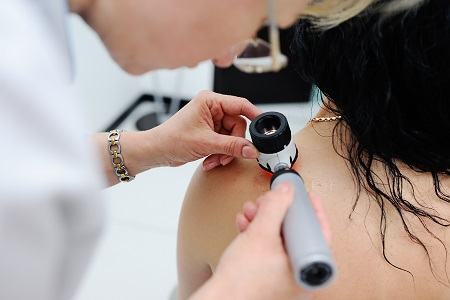 A melanoma és más bőrdaganatok korai felismerése anyajegyszűréssel valósulhat meg.