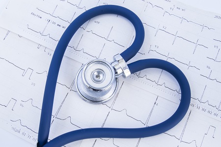 Az EKG eltérések okát kardiológusnak kell megkeresnie. 